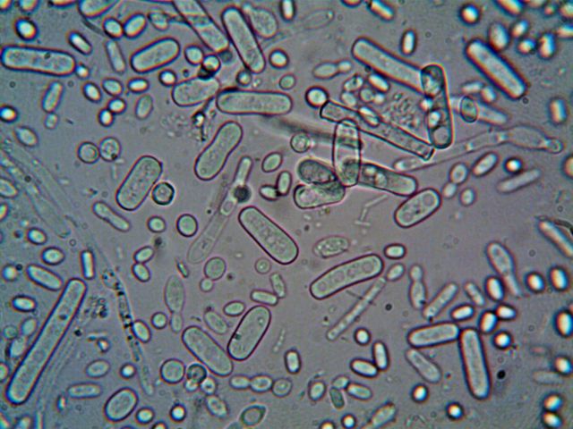 Soil microbes